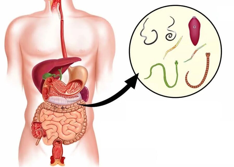 Vermixin помага при повечето видове хелминти