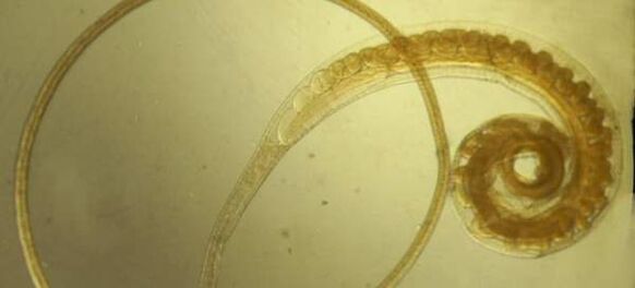 Камшичен червей