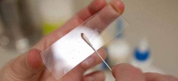 Остъргване за яйца на червеи